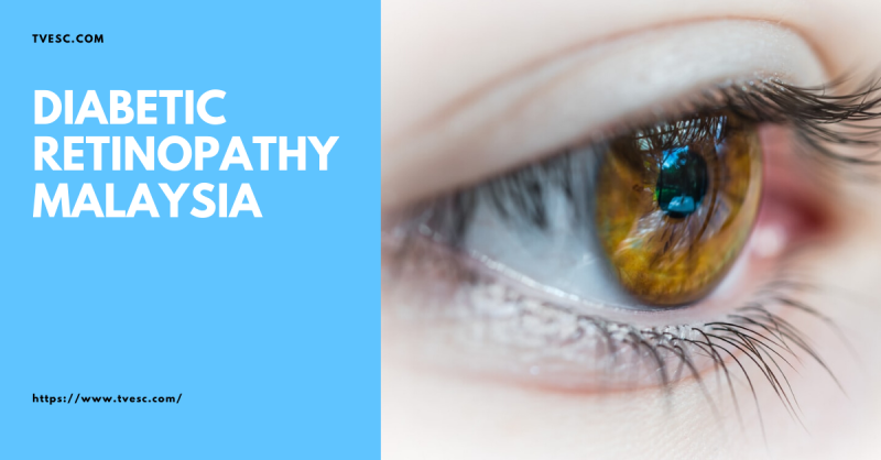 Underwater Scuba Diving Social Media Advertisement (8)